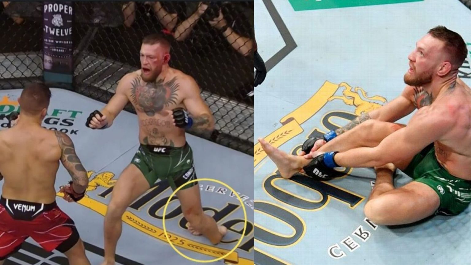 Fluky Injury! How Did Conor McGregor Break His Leg at UFC 264, Doctor ...